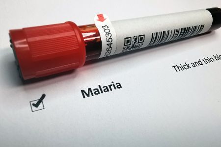 Blutprobe von mit Malaria infiziertem Blut